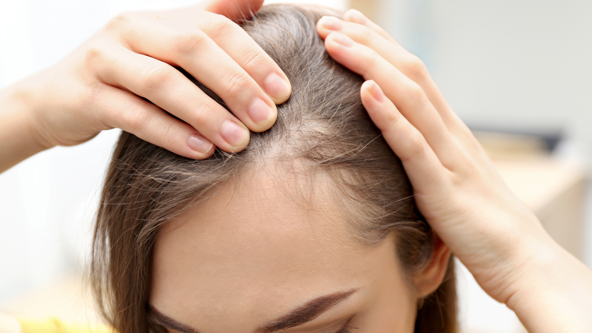 Postpartum Hair Loss